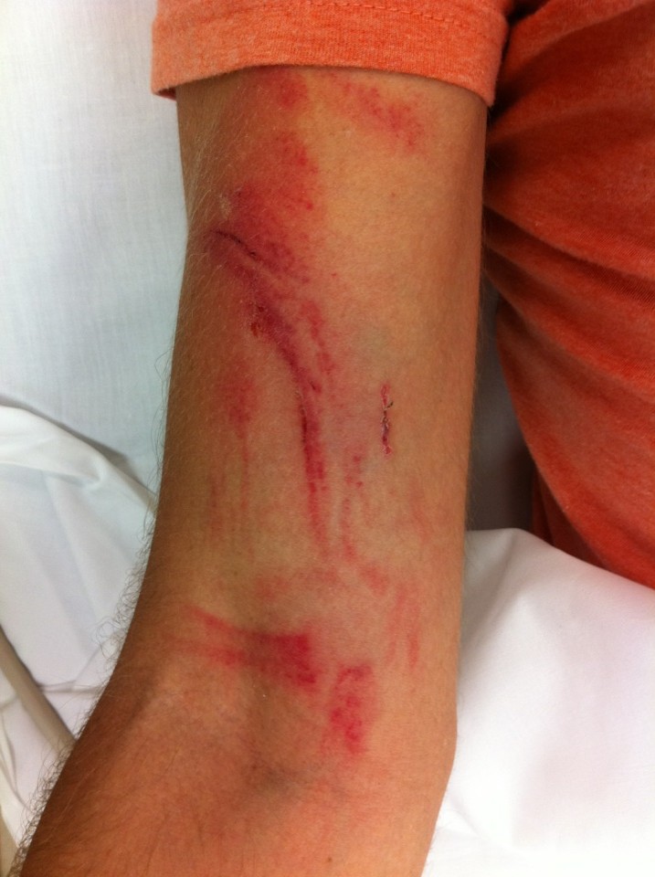 The Blogler Survives Wreck, Bloglemobile Does Not