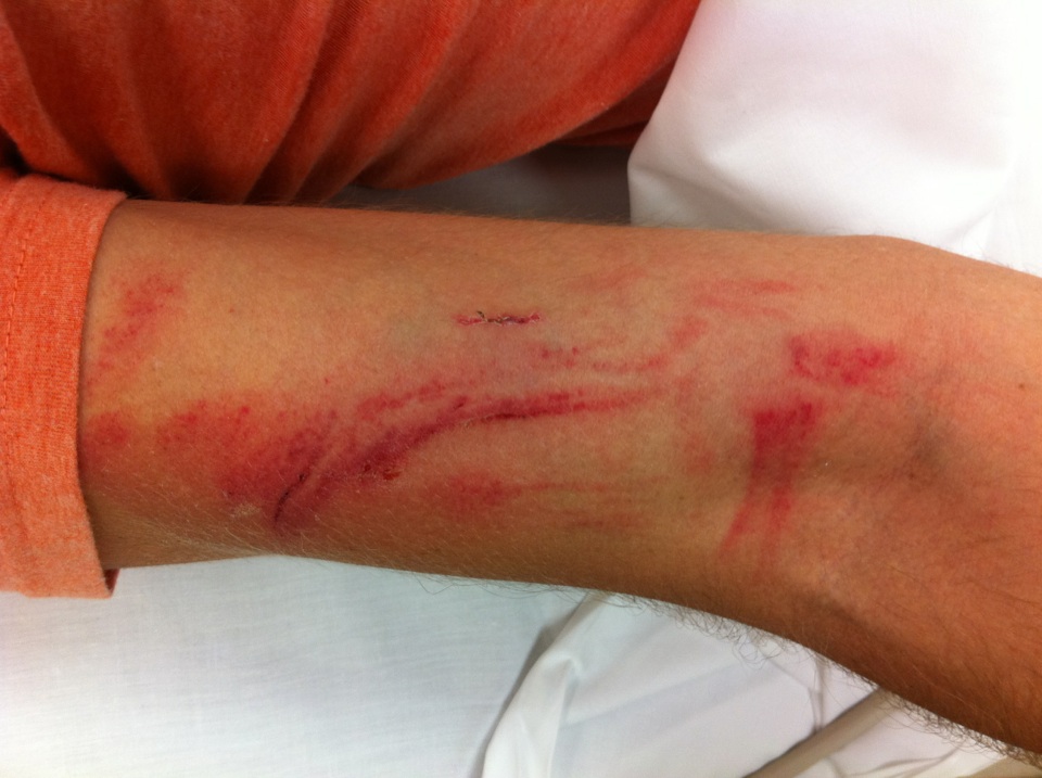 The Blogler Survives Wreck, Bloglemobile Does Not